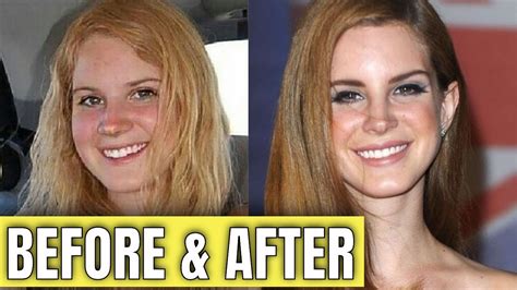 lana del rey nose surgery|lana del rey before after.